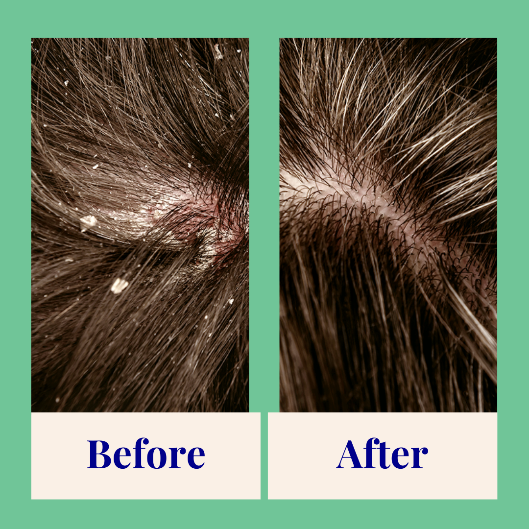 The Powder Shampoo Exfoliating & Balancing Shampoo (Thyme & Tea Tree) Beauty And Bath